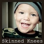 Skinned Knees